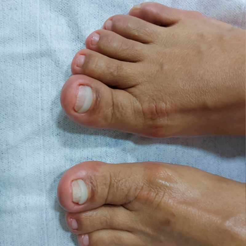 ORTONIXIAS4